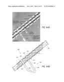EXPANDABLE SLIDE AND LOCK STENT diagram and image
