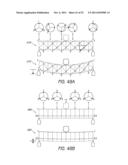 EXPANDABLE SLIDE AND LOCK STENT diagram and image