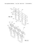 EXPANDABLE SLIDE AND LOCK STENT diagram and image