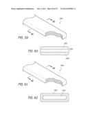 EXPANDABLE SLIDE AND LOCK STENT diagram and image