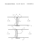 IMPLANTABLE PROSTHETIC DEVICE FOR CONNECTION TO A FLUID FLOW PATHWAY OF A     PATIENT diagram and image