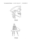 ASSISTED DENTAL IMPLANT TREATMENT AND REPLICATION SYSTEM diagram and image