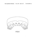 ASSISTED DENTAL IMPLANT TREATMENT AND REPLICATION SYSTEM diagram and image