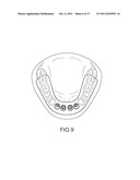 ASSISTED DENTAL IMPLANT TREATMENT AND REPLICATION SYSTEM diagram and image