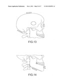 ASSISTED DENTAL IMPLANT TREATMENT AND REPLICATION SYSTEM diagram and image