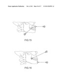 ASSISTED DENTAL IMPLANT TREATMENT AND REPLICATION SYSTEM diagram and image