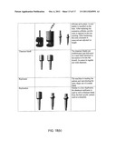 ASSISTED DENTAL IMPLANT TREATMENT AND REPLICATION SYSTEM diagram and image