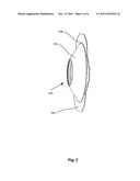 TRACHEOSTOMA PLASTER diagram and image