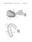 Dental Guard with Temporary Forming Tray diagram and image
