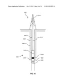 Sequenced packing element system diagram and image