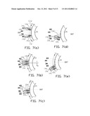 INDUCTION HEAT TREATMENT OF AN ANNULAR WORKPIECE diagram and image