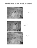 METHOD AND APPARATUS FOR SHIELDING MEDICAL PERSONNEL FROM RADIATION diagram and image