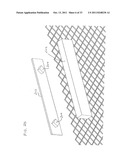 FENCE COVERING SYSTEM diagram and image