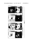 METHOD AND APPARATUS FOR MAGNETIC RESONANCE GUIDED HIGH INTENSITY FOCUSED     ULTRASOUND FOCUSING UNDER SIMULTANEOUS TEMPERATURE MONITORING diagram and image