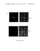 Group A Streptococcus Pharmaceutical Compositions and Methods Thereof diagram and image