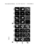 Method for Screening Cancer Therapeutic Agent Using Galectin-3,     GSK-3Betta, and Fascin-1 diagram and image