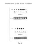 IL1RL-1 AS A CARDIOVASCULAR DISEASE MARKER AND THERAPEUTIC TARGET diagram and image