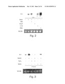 IL1RL-1 AS A CARDIOVASCULAR DISEASE MARKER AND THERAPEUTIC TARGET diagram and image