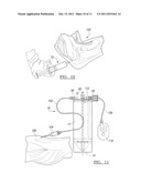 Method and Apparatus for Separating a Material diagram and image