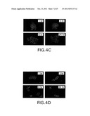 INHIBITORS OF PERITONEAL SEEDING OF CANCER CELLS diagram and image