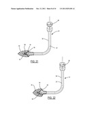 Method and Device for Attachment of an Inflow Conduit to the Heart and to     a Pump diagram and image