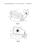 Method and Device for Attachment of an Inflow Conduit to the Heart and to     a Pump diagram and image