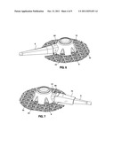 IMPLANTABLE COUPLING DEVICE diagram and image