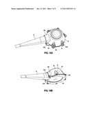 IMPLANTABLE COUPLING DEVICE diagram and image