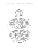 IMPLANTABLE COUPLING DEVICE diagram and image