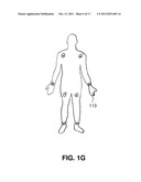 WIRELESS NANOTECHNOLOGY BASED SYSTEM FOR DIAGNOSIS OF NEUROLOGICAL AND     PHYSIOLOGICAL DISORDERS diagram and image