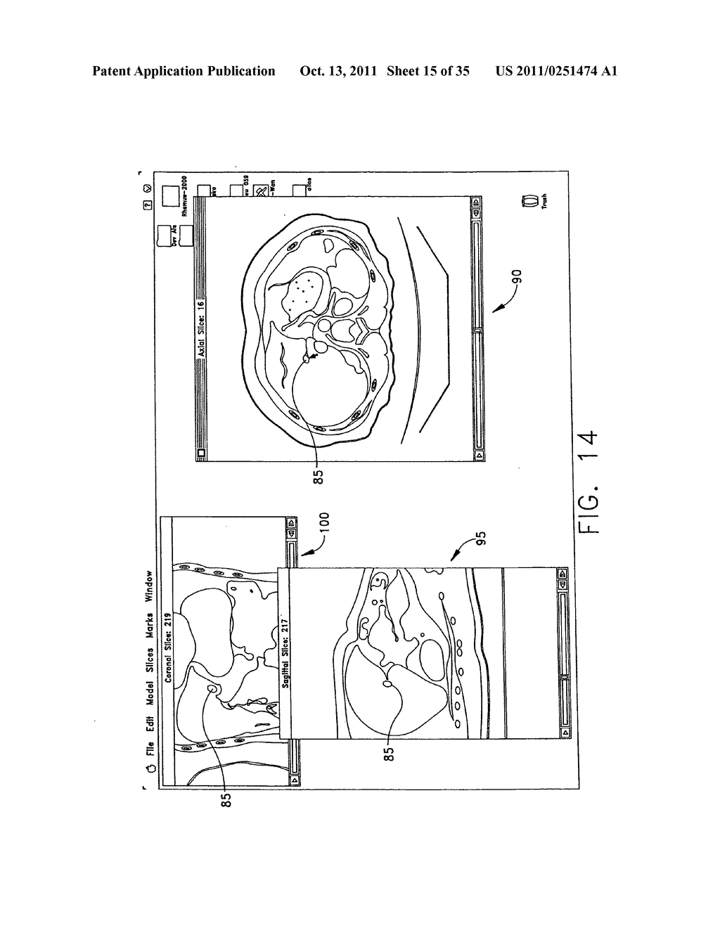 Anatomical visualization and measurement system - diagram, schematic, and image 16