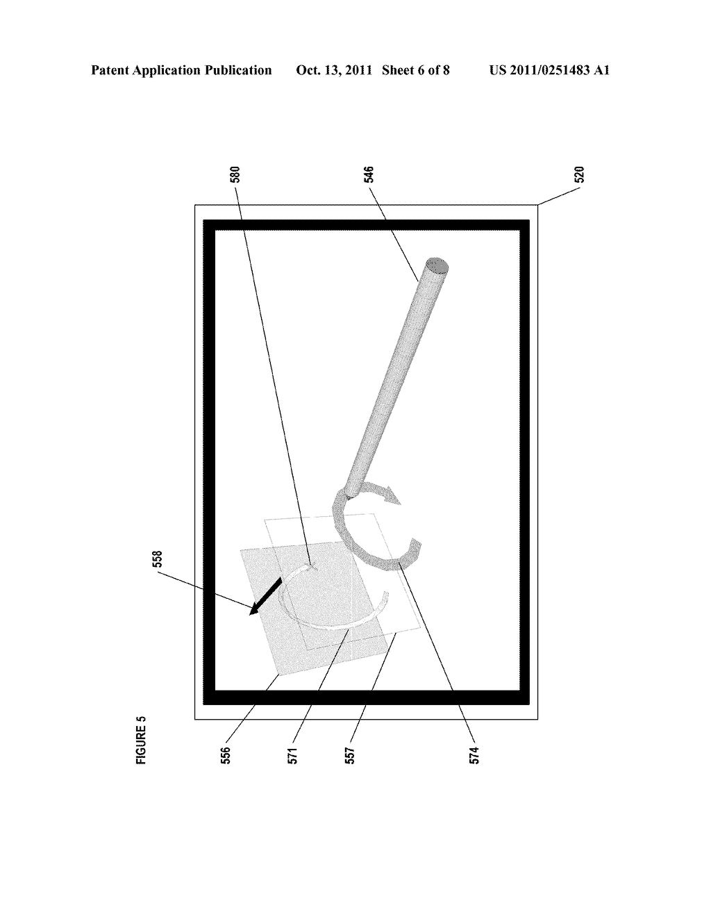 IMAGE ANNOTATION IN IMAGE-GUIDED MEDICAL PROCEDURES - diagram, schematic, and image 07