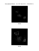 TRANSFECTION WITH MAGNETIC NANOPARTICLES AND ULTRASOUND diagram and image