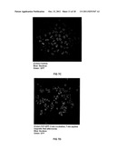 TRANSFECTION WITH MAGNETIC NANOPARTICLES AND ULTRASOUND diagram and image