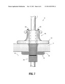 PORT FIXATION WITH FILAMENT ACTUATING MEMBER diagram and image