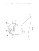 HAIR RESTORATION CARING DEVICE diagram and image