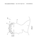 HAIR RESTORATION CARING DEVICE diagram and image