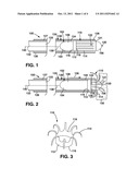 Slidable Fixation Device for  Securing a Medical Implant diagram and image