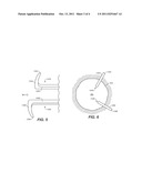 Anchor Pin Stent-Graft Delivery System diagram and image