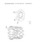 EXPANDABLE STENT THAT COLLAPSES INTO A NON-CONVEX SHAPE AND EXPANDS INTO     AN EXPANDED, CONVEX SHAPE diagram and image