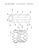 EXPANDABLE STENT THAT COLLAPSES INTO A NON-CONVEX SHAPE AND EXPANDS INTO     AN EXPANDED, CONVEX SHAPE diagram and image