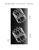 EXPANDABLE STENT THAT COLLAPSES INTO A NON-CONVEX SHAPE AND EXPANDS INTO     AN EXPANDED, CONVEX SHAPE diagram and image