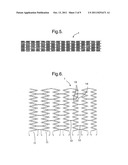 STENT SUITABLE FOR DEPLOYMENT IN A BLOOD VESSEL diagram and image