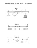 STENT SUITABLE FOR DEPLOYMENT IN A BLOOD VESSEL diagram and image