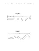 STENT SUITABLE FOR DEPLOYMENT IN A BLOOD VESSEL diagram and image