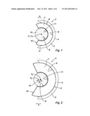 LINE OF COTYLOID IMPLANTS OF DIFFERENT SIZES diagram and image