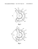 LINE OF COTYLOID IMPLANTS OF DIFFERENT SIZES diagram and image