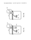 Cord Management System diagram and image