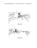 Cord Management System diagram and image