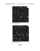 TREATMENT OF BRAIN DAMAGE USING UMBILICAL CORD BLOOD CELLS diagram and image